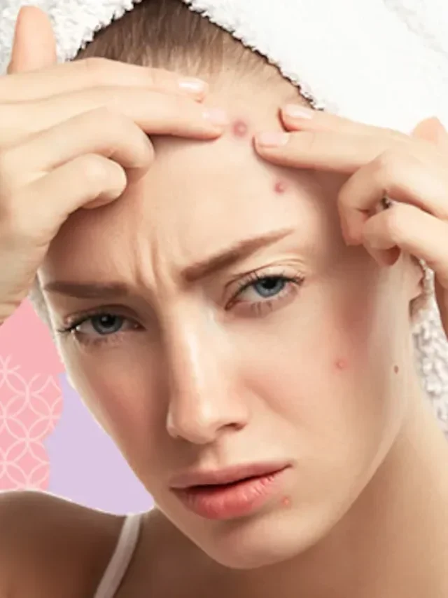 Recognize the Characteristics of 3 Types of Acne